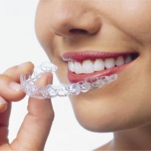 dr parekh and associates services invisalign background image